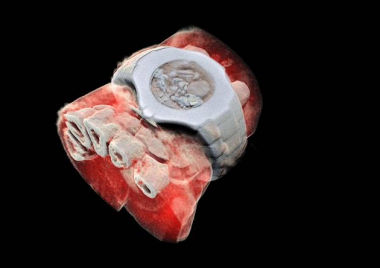 Prima radiografia in 3D a colori di un essere umano